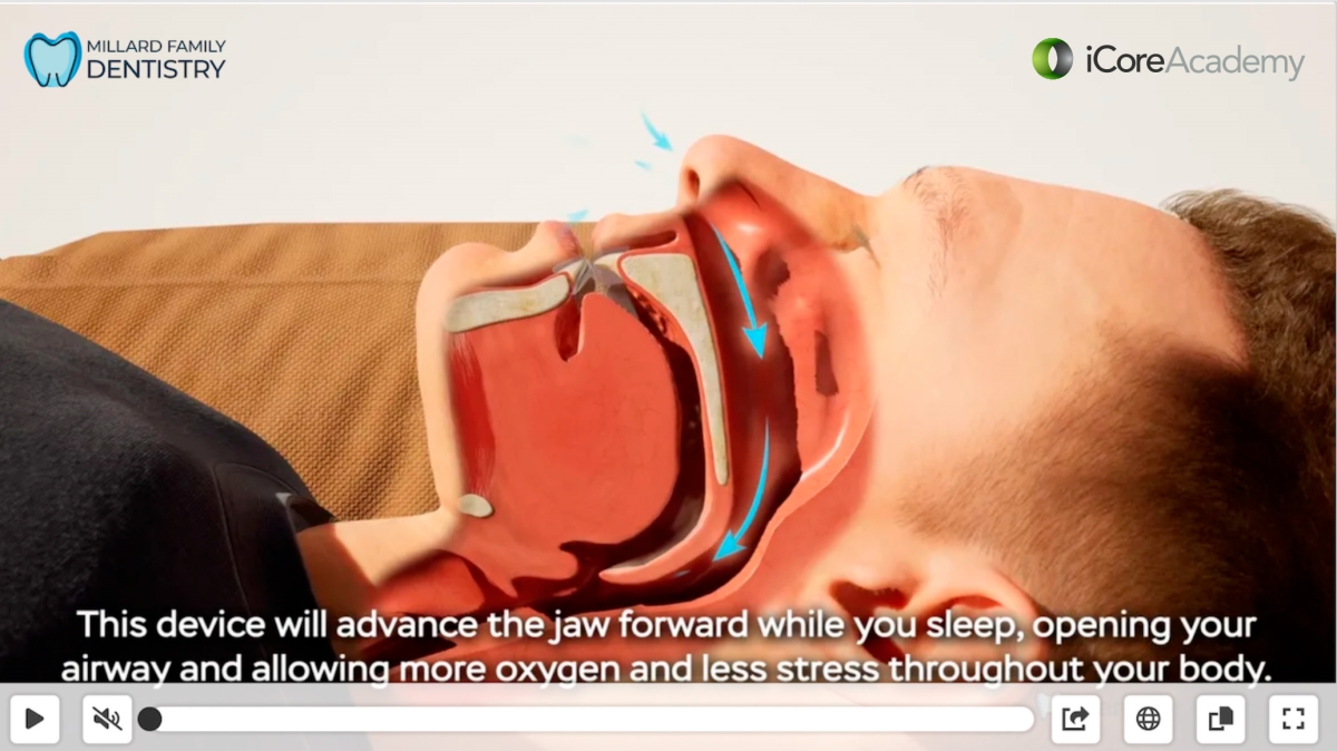 Optimized-Video Player with Sleep Apnea